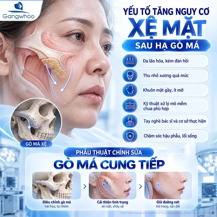 Hạ Gò Má Có Bị Xệ Mặt Không? Sự Thật Từ Góc Nhìn Chuyên Khoa Hàm Mặt
