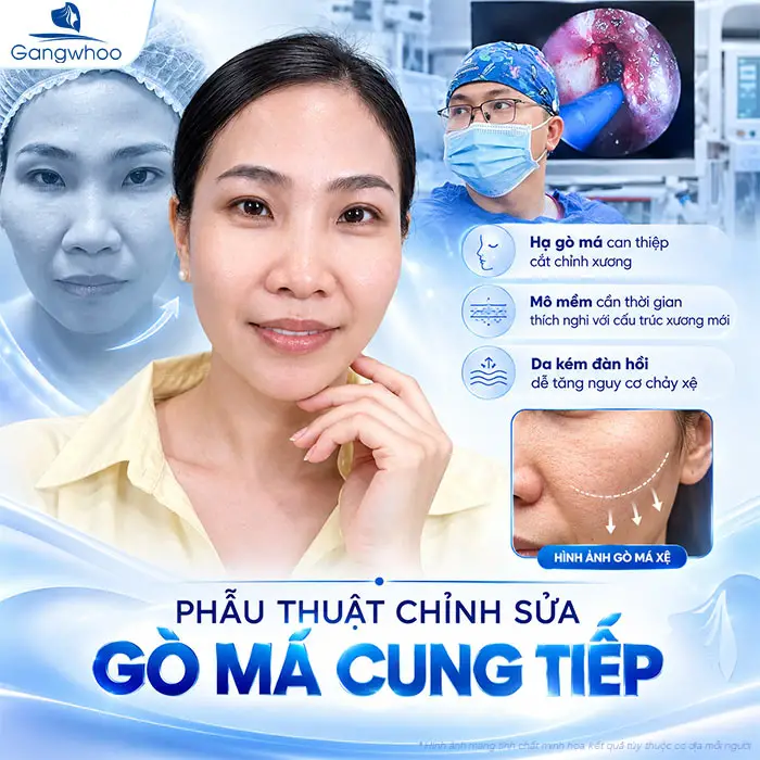 Hạ Gò Má Có Bị Xệ Mặt Không? Sự Thật Từ Góc Nhìn Chuyên Khoa Hàm Mặt