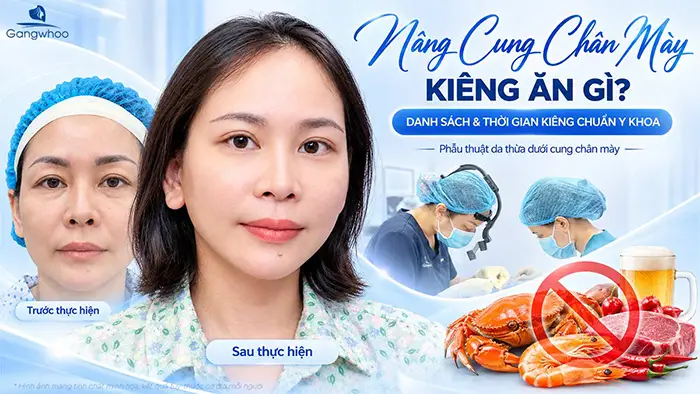 Nâng Cung Chân Mày Kiêng Ăn Gì? Danh Sách & Thời Gian Kiêng Chuẩn Y Khoa